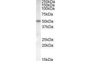 Western Blotting (WB) image for Cholinergic Receptor, Nicotinic, beta 3 (Neuronal) (CHRNB3) peptide (ABIN369921) (Cholinergic Receptor, Nicotinic, beta 3 (Neuronal) (CHRNB3) Peptid)