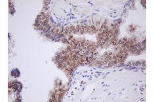 Image no. 4 for anti-Transducin-Like Enhancer of Split 1 (E(sp1) Homolog, Drosophila) (TLE1) (AA 180-460) antibody (ABIN1491051) (TLE1 Antikörper  (AA 180-460))