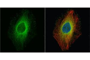 Immunofluorescence (IF) image for anti-rho-Associated, Coiled-Coil Containing Protein Kinase 1 (ROCK1) (N-Term) antibody (ABIN2856887)