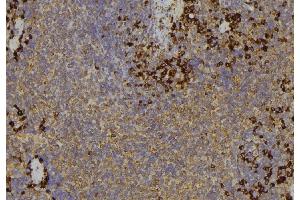 ABIN6279565 at 1/100 staining Human lymph node tissue by IHC-P. (MYO5C Antikörper)