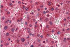 Liver, Human: Formalin-Fixed, Paraffin-Embedded (FFPE) (TIMP2 Antikörper)