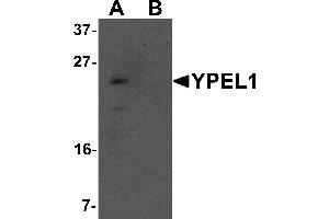 Western blot analysis of YPEL1 in Hela cell lysate with YPEL1 antibody at 1 µg/mL in (A) the absence and (B) the presence of blocking peptide. (YPEL1 Antikörper  (N-Term))