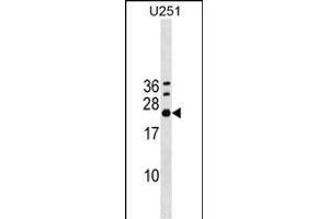 EXOSC4 Antibody (Center) (ABIN1538571 and ABIN2848888) western blot analysis in  cell line lysates (35 μg/lane). (EXOSC4 Antikörper  (AA 69-96))