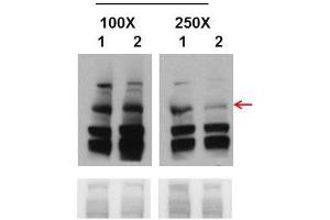 Western Blot with Cell line 293T (Embyonic human kidney cells) tissue (BRCA1 Antikörper  (Middle Region))
