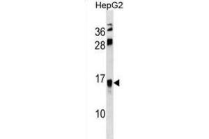 Western Blotting (WB) image for anti-Resistin Like beta (RETNLB) antibody (ABIN3000751) (RETNLB Antikörper)