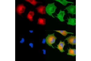 ABIN7094989 and ABIN7099045 staining  cells by IF/ICC. (RRBP1 Antikörper)