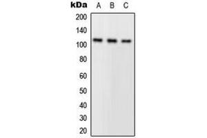 Western blot analysis of PLA2G4A expression in A549 (A), HeLa (B), mouse kidney (C) whole cell lysates. (PLA2G4A Antikörper  (N-Term))