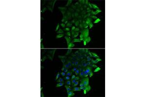 Immunofluorescence analysis of U2OS cells using SEPSECS antibody (ABIN6131515, ABIN6147545, ABIN6147546 and ABIN6222910). (SEPSECS Antikörper  (AA 222-501))