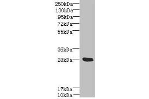 Western blot All lanes: YIPF5 antibody at 5 μg/mL + Mouse liver tissue Secondary Goat polyclonal to rabbit IgG at 1/10000 dilution Predicted band size: 28, 22, 30 kDa Observed band size: 28 kDa (YIPF5 Antikörper  (AA 1-124))