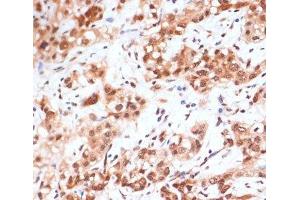 Immunohistochemistry (Paraffin-embedded Sections) (IHC (p)) image for anti-Signal Transducer and Activator of Transcription 1, 91kDa (STAT1) (pSer727) antibody (ABIN7265092)