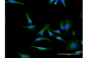 Immunofluorescence of monoclonal antibody to PHB on HeLa cell. (Prohibitin Antikörper  (AA 1-272))