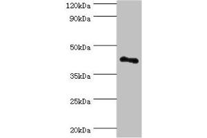 Western blot All lanes: RSAD2 antibody at 8 μg/mL + Jurkat whole cell lysate Secondary Goat polyclonal to rabbit IgG at 1/10000 dilution Predicted band size: 42 kDa Observed band size: 42 kDa (RSAD2 Antikörper  (AA 42-361))