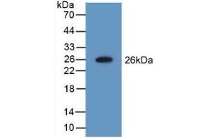 Detection of Recombinant NME5, Mouse using Polyclonal Antibody to Non Metastatic Cells 5, Protein NM23A Expressed In (NME5)