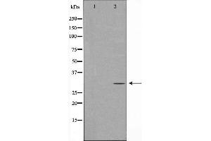 Western blot analysis of Hepg2 whole cell lysates, using PNMT Antibody. (PNMT Antikörper  (N-Term))