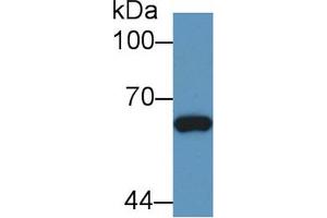 Western blot analysis of Human Hela cell lysate, using Rabbit Anti-Cow Smad1 Antibody (1 µg/ml) and HRP-conjugated Goat Anti-Rabbit antibody (abx400043, 0. (SMAD1 Antikörper  (AA 270-465))