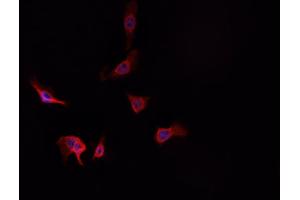 ABIN6269225 staining A-431 cells by IF/ICC.