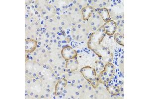 Immunohistochemistry of paraffin-embedded mouse kidney using MTERFD3 antibody at dilution of 1:100 (x40 lens). (MTERFD3 Antikörper)