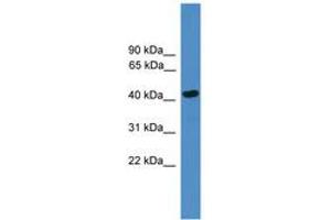 Image no. 1 for anti-serpin Peptidase Inhibitor, Clade B (Ovalbumin), Member 13 (SERPINB13) (AA 180-229) antibody (ABIN6745435) (SERPINB13 Antikörper  (AA 180-229))