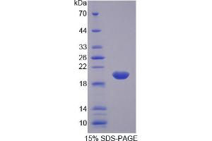 Image no. 1 for Arginyl-tRNA Synthetase (RARS) (AA 1-146) protein (His tag) (ABIN6236948)