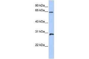 WB Suggested Anti-HOXA5 Antibody Titration: 1 ug/ml Positive Control: Placenta (HOXA5 Antikörper  (C-Term))