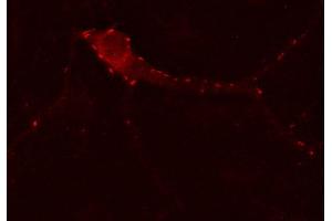 Indirect immunostaining of PFA fixed hippocampus neurons (dilution 1 : 500). (GABRG2 Antikörper)