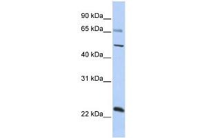 WB Suggested Anti-ZNF597 Antibody Titration:  0.