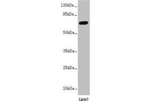 PPP2R3B Antikörper  (Regulatory Subunit B)