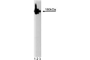 Western Blotting (WB) image for anti-Synaptosomal-Associated Protein 91 (SNAP91) (AA 706-896) antibody (ABIN967993)