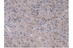 Immunohistochemistry (IHC) image for anti-Ubiquitin-Conjugating Enzyme E2L 3 (UBE2L3) (AA 4-154) antibody (ABIN7441196)