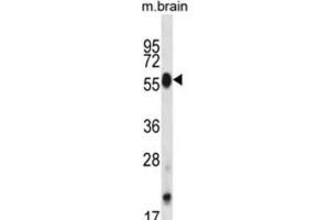 Western Blotting (WB) image for anti-CDC-Like Kinase 4 (CLK4) antibody (ABIN2998111) (CLK4 Antikörper)