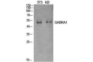Western Blotting (WB) image for anti-gamma-aminobutyric Acid (GABA) A Receptor, alpha 1 (GABRA1) (Internal Region) antibody (ABIN3181422) (GABRA1 Antikörper  (Internal Region))