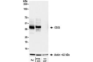 Western Blotting (WB) image for anti-Fc Fragment of IgE, Low Affinity II, Receptor For (CD23) (FCER2) (AA 48-321) antibody (ABIN7795823)
