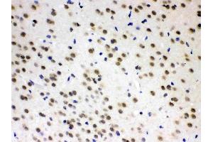AZIN2 was detected in paraffin-embedded sections of rat brain tissues using rabbit anti- AZIN2 Antigen Affinity purified polyclonal antibody (Catalog # ) at 1 ? (ADC Antikörper  (AA 111-301))