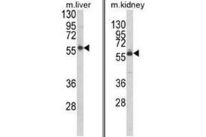 (LEFT) Western blot analysis of PRODH Antibody (RB21343) in mouse liver tissue lysates (35ug/lane). (PRODH Antikörper  (Middle Region))
