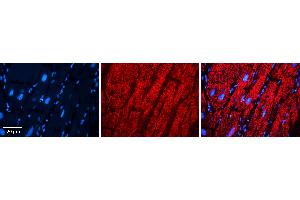 Rabbit Anti-EPRS Antibody   Formalin Fixed Paraffin Embedded Tissue: Human heart Tissue Observed Staining: Cytoplasmic Primary Antibody Concentration: N/A Other Working Concentrations: 1:600 Secondary Antibody: Donkey anti-Rabbit-Cy3 Secondary Antibody Concentration: 1:200 Magnification: 20X Exposure Time: 0. (EPRS Antikörper  (Middle Region))