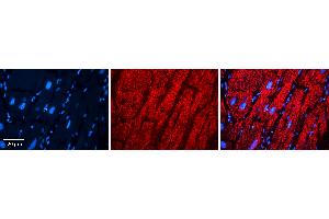 Rabbit Anti-EPRS Antibody   Formalin Fixed Paraffin Embedded Tissue: Human heart Tissue Observed Staining: Cytoplasmic Primary Antibody Concentration: N/A Other Working Concentrations: 1:600 Secondary Antibody: Donkey anti-Rabbit-Cy3 Secondary Antibody Concentration: 1:200 Magnification: 20X Exposure Time: 0.