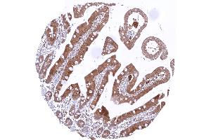 Duodenum with strong cytoplasmic caspase 3 positivity of epithelial cells (Rekombinanter Caspase 3 Antikörper  (Center))