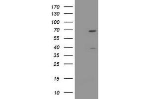 Image no. 1 for anti-tRNA Methyltransferase 2 Homolog A (TRMT2A) antibody (ABIN1501522) (TRMT2A Antikörper)
