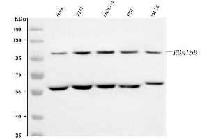 Western blot analysis of RBM15B using anti-RBM15B antibody (ABIN7600219).