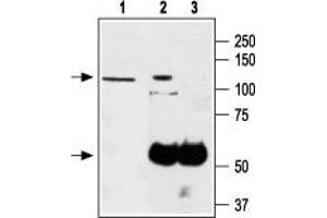 Immunoprecipitation of PC-12 lysates: - 1. (TRPA1 Antikörper  (1st Extracellular Loop))