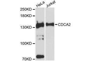 Western blot analysis of extracts of various cell lines, using CDCA2 antibody (ABIN5996800) at 1:3000 dilution. (CDCA2 Antikörper)
