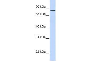 WB Suggested Anti-LST-3TM12 Antibody Titration:  0. (LST-3TM12 Antikörper  (Middle Region))