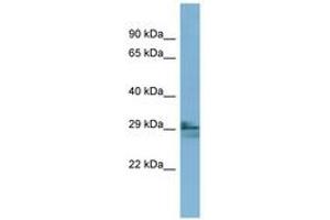 Image no. 1 for anti-Lens Intrinsic Membrane Protein 2, 19kDa (LIM2) (AA 35-84) antibody (ABIN6741876) (LIM2 Antikörper  (AA 35-84))