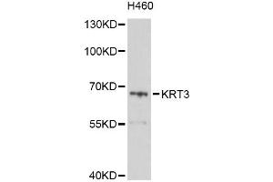 Western blot analysis of extracts of H460 cells, using KRT3 Antibody (ABIN6003816) at 1/1000 dilution. (Keratin 3 Antikörper)