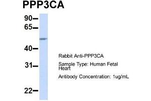 Western Blotting (WB) image for anti-Protein Phosphatase 3, Catalytic Subunit, alpha Isoform (PPP3CA) (Middle Region) antibody (ABIN2784524)