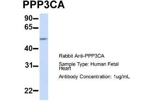 Host:  Rabbit  Target Name:  PPP3CA  Sample Type:  Human Fetal Heart  Antibody Dilution:  1. (PPP3CA Antikörper  (Middle Region))