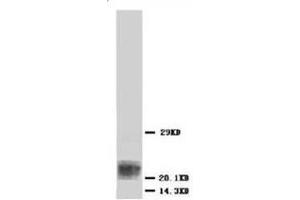 Western blot analysis of Hela cell lysis using BAX antibody (BAX Antikörper  (N-Term))