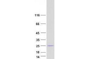 Validation with Western Blot (MED8 Protein (Transcript Variant 1) (Myc-DYKDDDDK Tag))