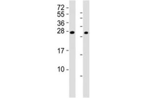 Western blot testing of RHOXF1 antibody at 1:2000