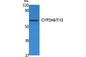 Western Blotting (WB) image for anti-CYP2A6/7/13 (Internal Region) antibody (ABIN3178124) (CYP2A6/7/13 (Internal Region) Antikörper)